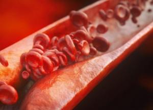 Медики назвали первые симптомы повышенного холестерина