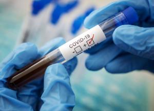 В Украине выявили 8147 новых заражений коронавирусом