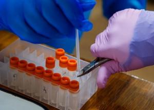 В Украине 15 053 новых случая коронавируса