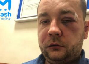 Головой об капот: в России таксист жестоко расправился с пассажиром