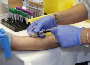 Ученые научились прогнозировать "износ" организма