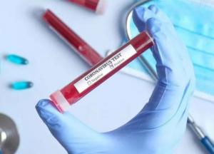 В Украине уже 145 тыс. случаев COVID-19, за сутки - 2 582