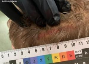 Пятерых черкасских полицейских будут судить за пытки мужчины