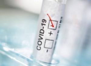 В Минздраве пояснили, кому грозит повторное заражение COVID