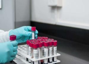 Медики назвали группу крови, обладатели которой реже всего болеют раком