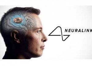 Ілон Маск чіпує людину в прямому ефірі: Neuralink вживлять у мозок пацієнта