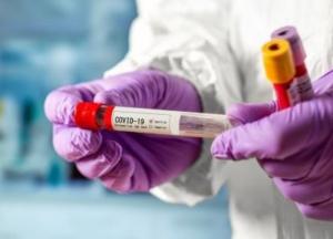 В Украине обнаружено уже более 74,2 тыс. случаев COVID-19, за сутки - 1061