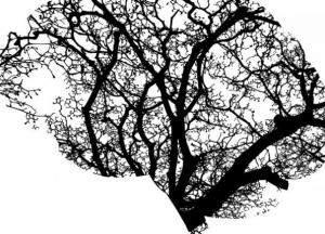 Врач назвал главные симптомы опухоли головного мозга