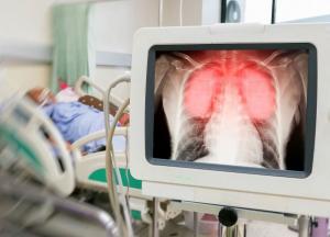 В Украине рекордная суточная смертность от COVID