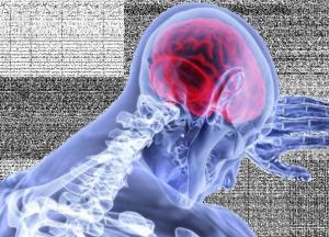 Медики назвали самый эффективный способ снижения риска инсульта