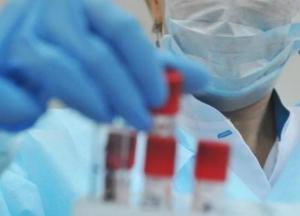 В Украине 12 287 новых случаев коронавируса