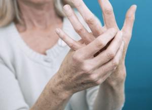 Названы три симптома артрита, сигнализирующие, что болезнь стала опасной для жизни