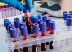 В Британии от коронавируса умерли почти 10 тысяч человек