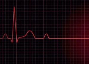 Ученые выявили причину внезапной остановки сердца у здоровых людей