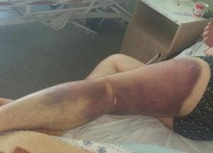 В Николаеве полицейских подозревают в пытках (фото, видео)