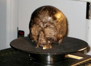 Ученые рассказали, как мог сохраниться один из старейших мозгов человека