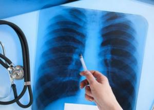 У львовской учительницы 1-х классов оказалась открытая форма туберкулеза