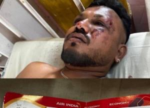 Авіакатастрофа в Індії: з 242 пасажирів вижив лише один, він встав і пішов (відео)