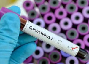 В Украине количество больных COVID-19 может достичь 200 тыс. или несколько миллионов - Минздрав