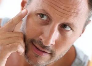 Онколог рассказал, какие проблемы со здоровьем можно увидеть по лицу