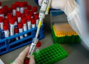 В Украине свыше 4 тыс. новых случаев коронавируса за сутки