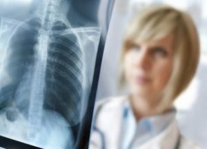 Ученые открыли механизм самоуничтожения туберкулеза