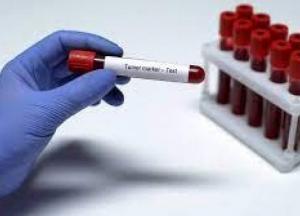 Почему общий анализ крови является обязательным при ряде болезней
