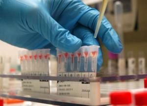  Врачи назвали группу крови, при которой чаще болеют раком