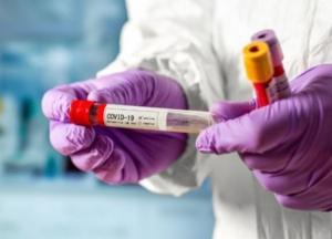 В Украине 1385 новых случаев коронавируса