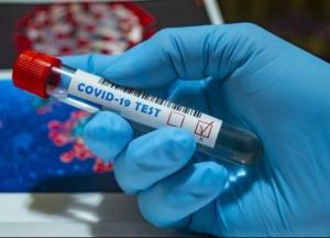 В Украине более 800 новых случаев COVID-19