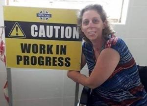 Жительница Южной Африки лишилась рук и ног из-за укуса мангуста (фото)