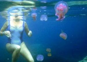 Что делать, если ужалила медуза