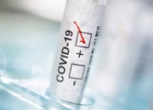 В Украине 6237 новых COVID-случаев