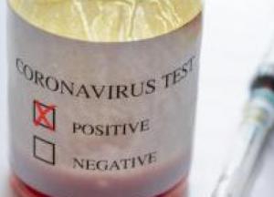 На Львовщине у священника УГКЦ подтвердили коронавирус