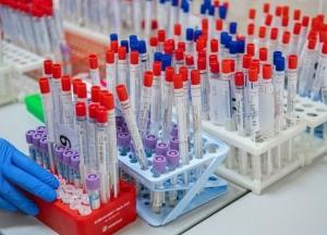 В Украине уже 94,4 тыс. случаев COVID-19, за сутки - 1 616