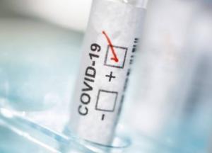 В Украине более 15 тысяч случаев COVID-19 за день