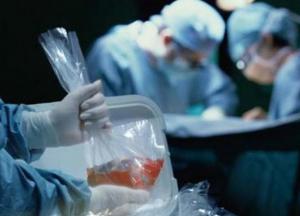 На Киевщине полиция проверяет факты незаконной трансплантации человеческих органов в частном медцентре