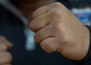 В Одесской области мужчина сломал нос продавщице цветочного магазина