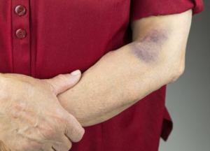 5 опасных симптомов, которые нельзя игнорировать