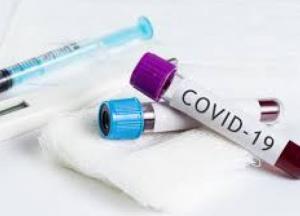 В Минздраве назвали критические симптомы коронавируса