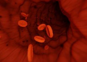 Медики объяснили, как распознать образовавшийся в венах тромб 