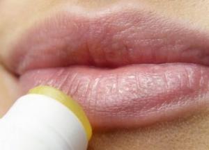 В Днепре медики спасают школьницу: пыталась сама себе увеличить губы (видео)