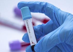 В Украине более 33 тысяч новых случаев COVID-19