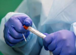 Волна растет: в Украине 4640 новых заражений COVID-19