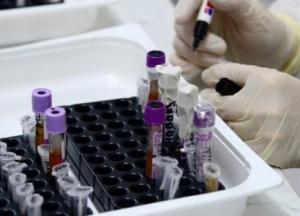 В Украине 1247 новых случаев коронавируса