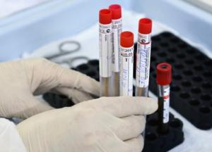 В Украине уже почти 88 тыс. случаев COVID-19, за сутки антирекорд - 1 732