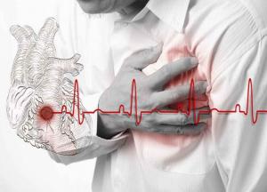 Кардиологи предупредили о скрытых признаках инфаркта