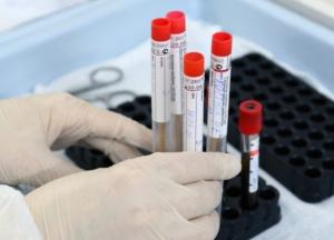 В Украине уже более 110 тыс. случаев COVID-19, за сутки - 1670