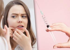 Создана прививка против прыщей