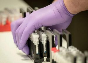 В Украине зафиксировано 156 случаев COVID-19